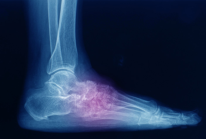 foot and ankle scan